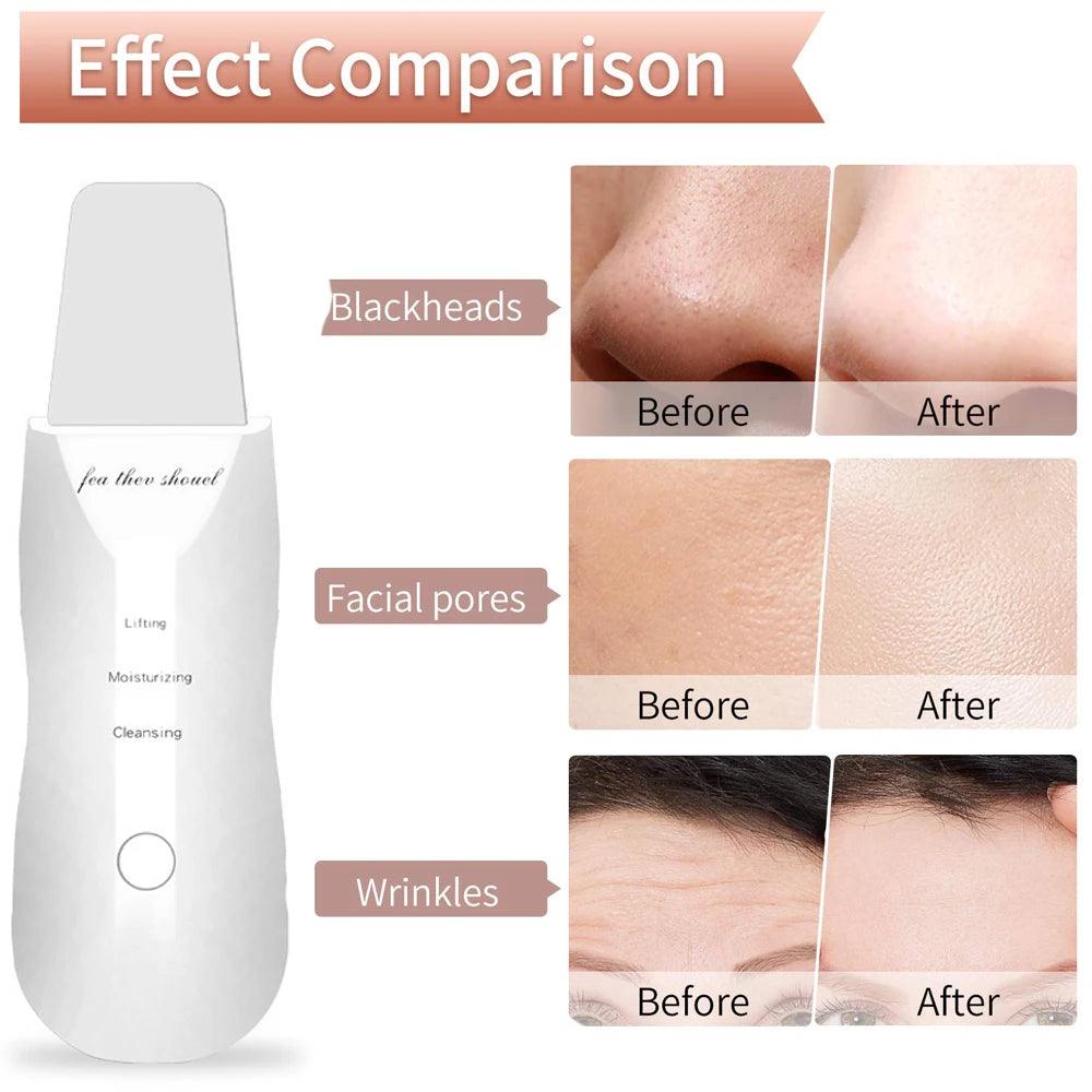 Facial Cleansing Brush - Deep Cleansing And Blackhead Removal With Massage, Valentine's Day Gift